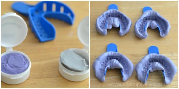 teeth molds for invisible aligners